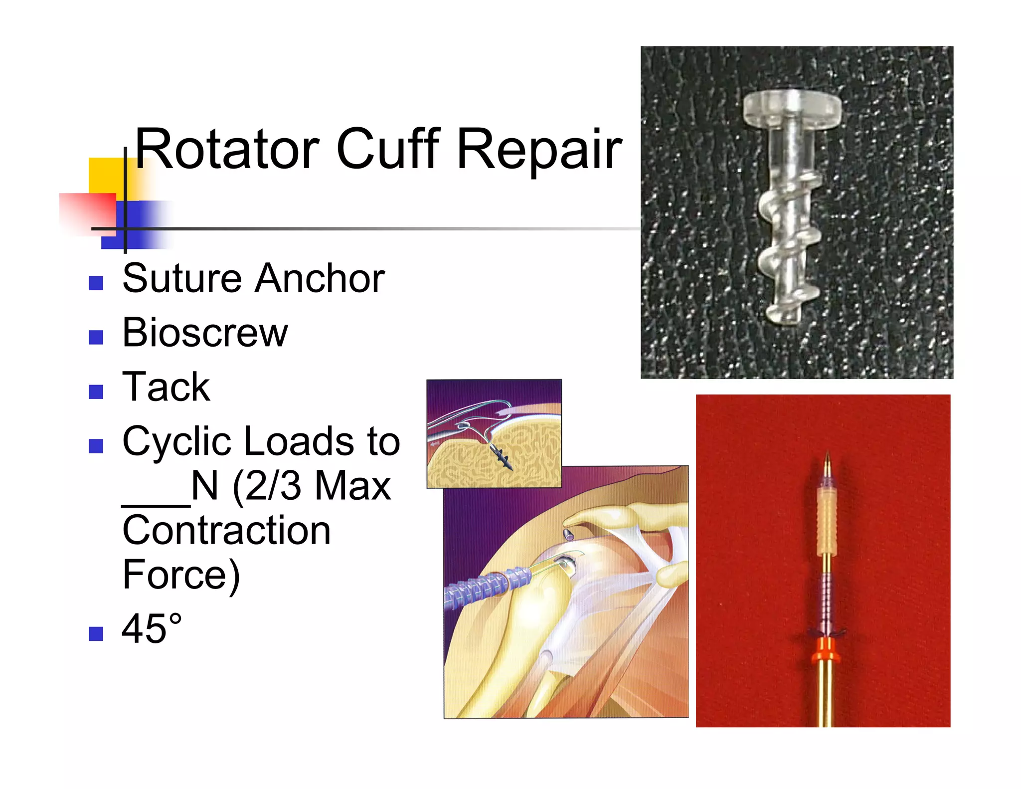 30
Rotator Cuff Repair
„ Suture Anchor
„ Bioscrew
„ Tack
„ Cyclic Loads to
___N (2/3 Max
Contraction
Force)
„ 45°
 