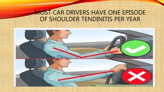 Shoulder orthopedic disorders (dr.farouk) | PPTX