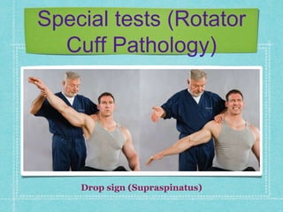 Shoulder pain | PPTX