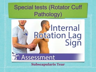 Shoulder pain | PPTX