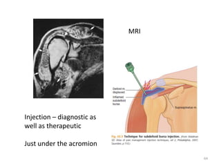SHOULDER PAIN Diff. Diagnosis RB.pptx