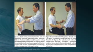 08
Burbank et al, Chronic shoulder pain part I, Am Fam Physician 2008
 