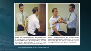 Burbank et al, Chronic shoulder pain part I, Am Fam Physician 2008
 