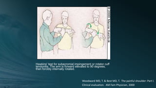 Hawkins' test for subacromial impingement or rotator cuff
tendonitis. The arm is forward elevated to 90 degrees,
then forcibly internally rotated.
Woodward MD, T. & Best MD, T. The painful shoulder: Part I.
Clinical evaluation. AM Fam Physician, 2000
 