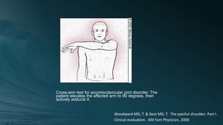 Cross-arm test for acromioclavicular joint disorder. The
patient elevates the affected arm to 90 degrees, then
actively adducts it.
Woodward MD, T. & Best MD, T. The painful shoulder: Part I.
Clinical evaluation. AM Fam Physician, 2000
 