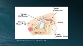 Burbank et al, Chronic shoulder pain part I, Am Fam Physician 2008
 