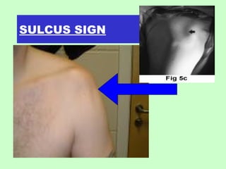 Shoulder ppt | PPT