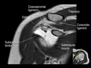shoulder radioanatomy.pptx