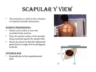 Angled Recumbency SHOULDER'S RADIOGRAPHIC PROJECTIONS .pptx