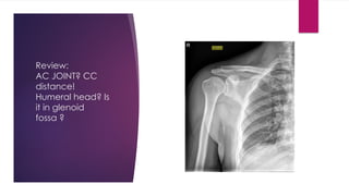 Shoulder Radiographic imaging EMERGENCY PAIN.pptx