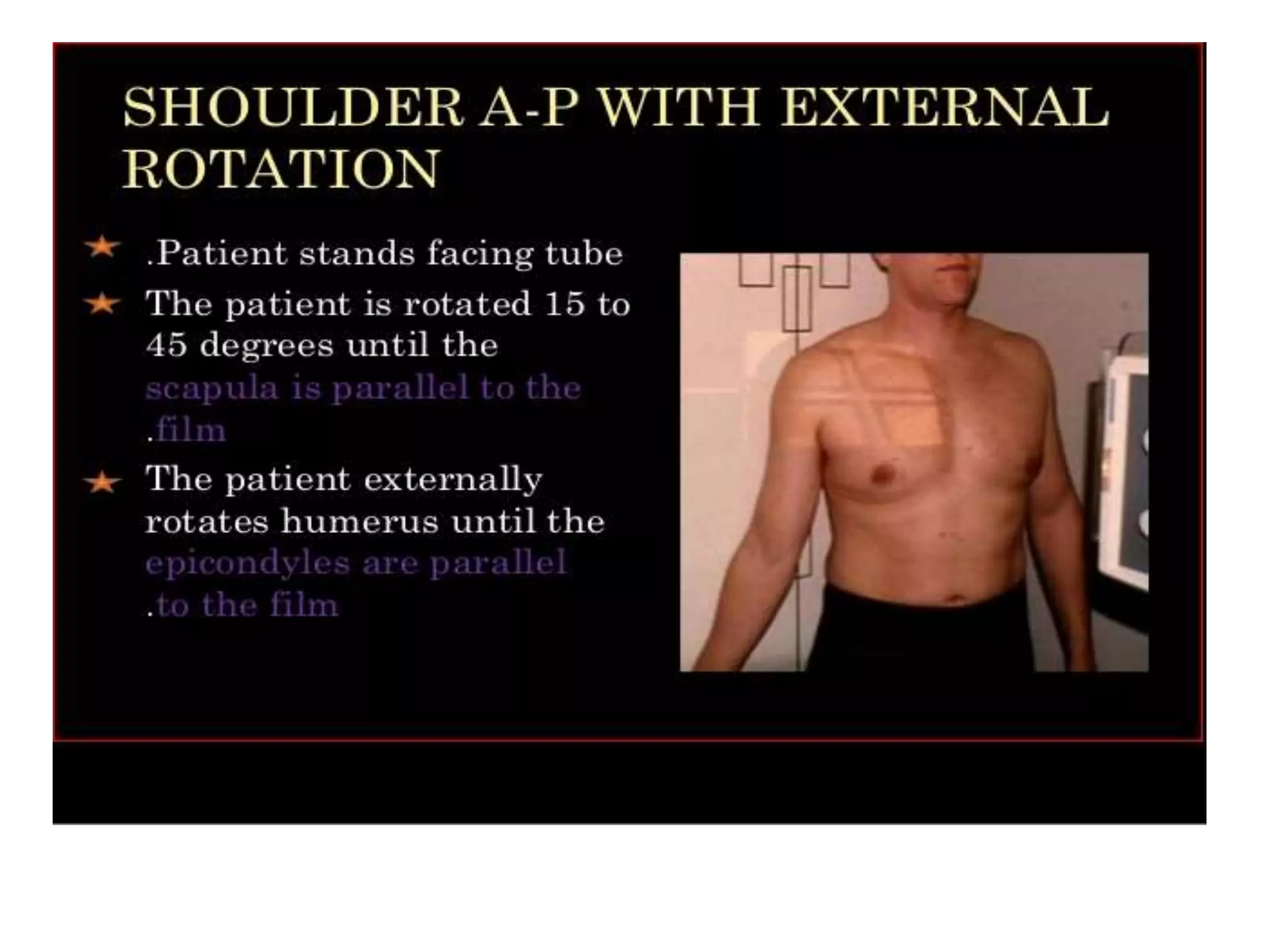 Shoulder Internal Rotation Radiography Positioning Shoulder radiologic anatomy | PPTX