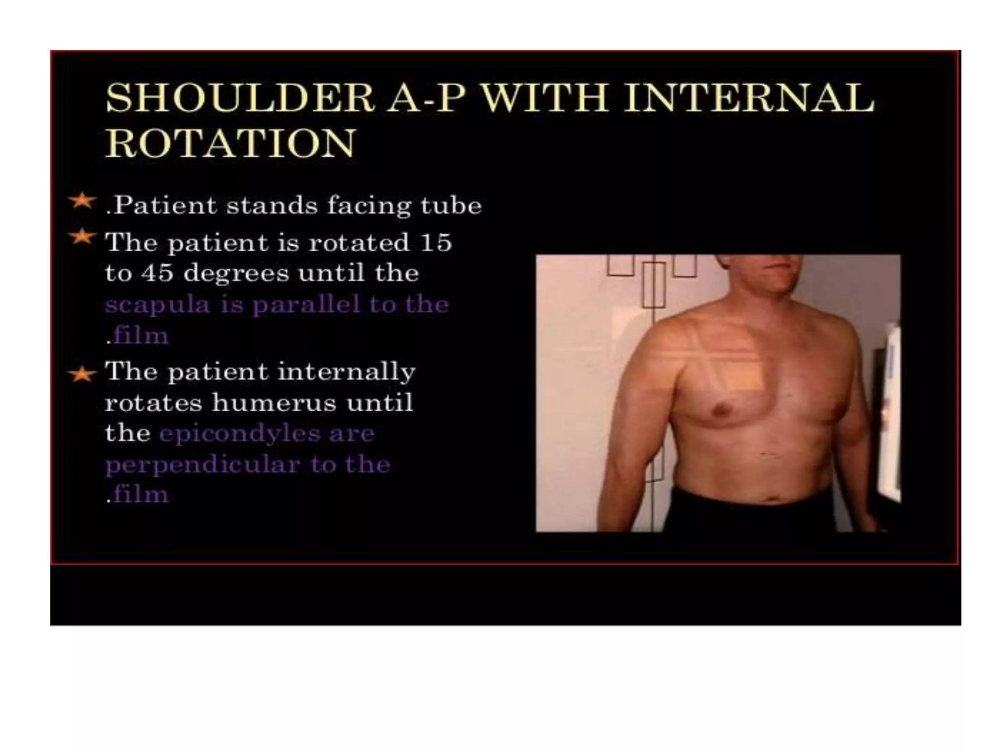 Shoulder radiologic anatomy | PPTX