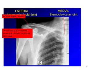 Shoulder radiologic anatomy | PPTX