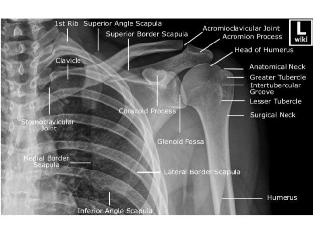 Shoulder radiologic anatomy