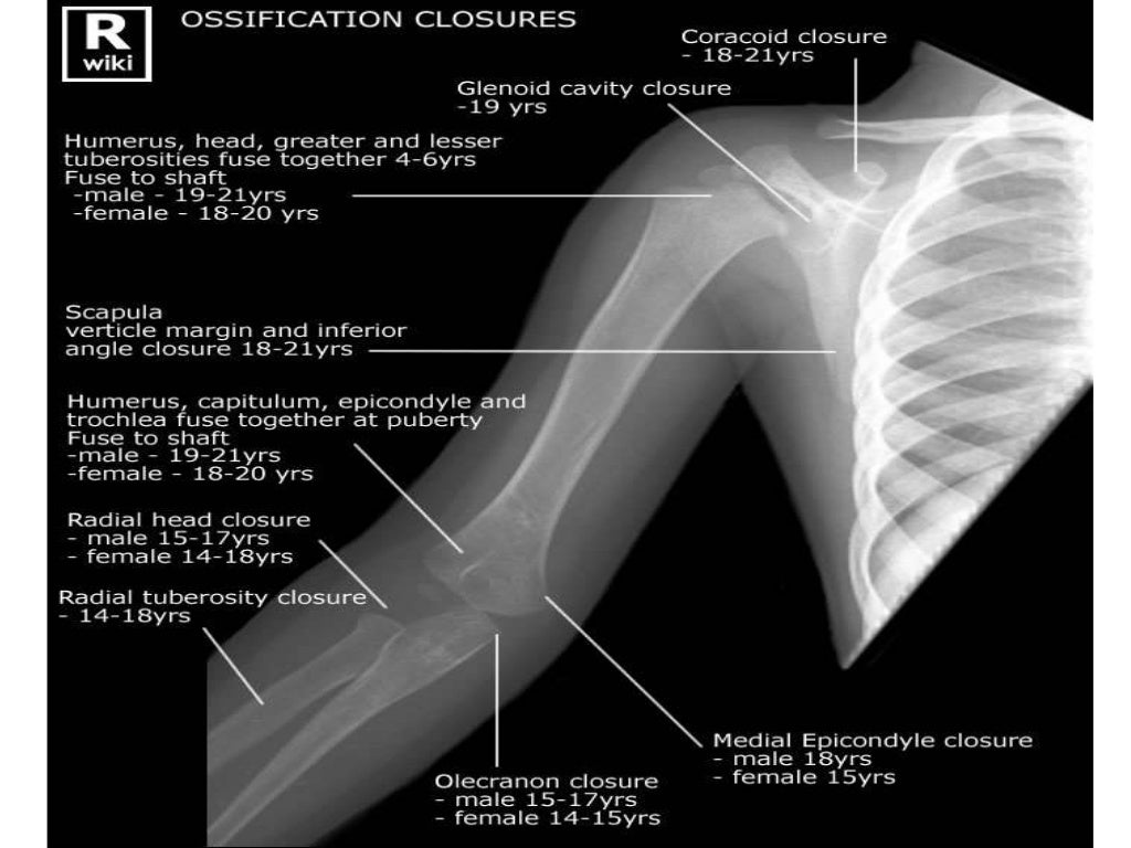 Shoulder radiologic anatomy