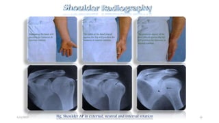 Shoulder radiography avinesh shrestha | PPTX