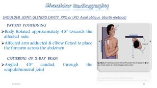 Lpo Radiography Shoulder radiography avinesh shrestha | PPTX