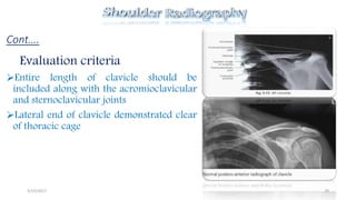 Shoulder radiography avinesh shrestha | PPTX
