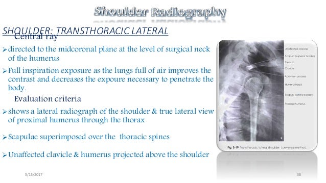 Shoulder radiography avinesh shrestha