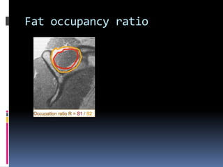 Fat occupancy ratio 
 