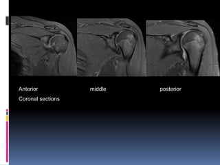Anterior middle posterior 
Coronal sections 
 
