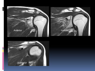 Anterior middle 
posterior 
 