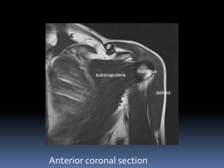 Anterior coronal section 
 