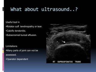 What about ultrasound..? 
Useful tool in 
•Rotator cuff tendinopathy or tear. 
•Calcific tendonitis. 
•Subacromial bursal effusion. 
Limitations 
•Many parts of joint can not be 
assessed. 
•Operator dependent 
 
