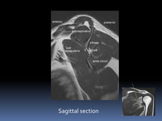 Sagittal section 
 
