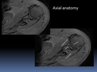 Axial anatomy 
 