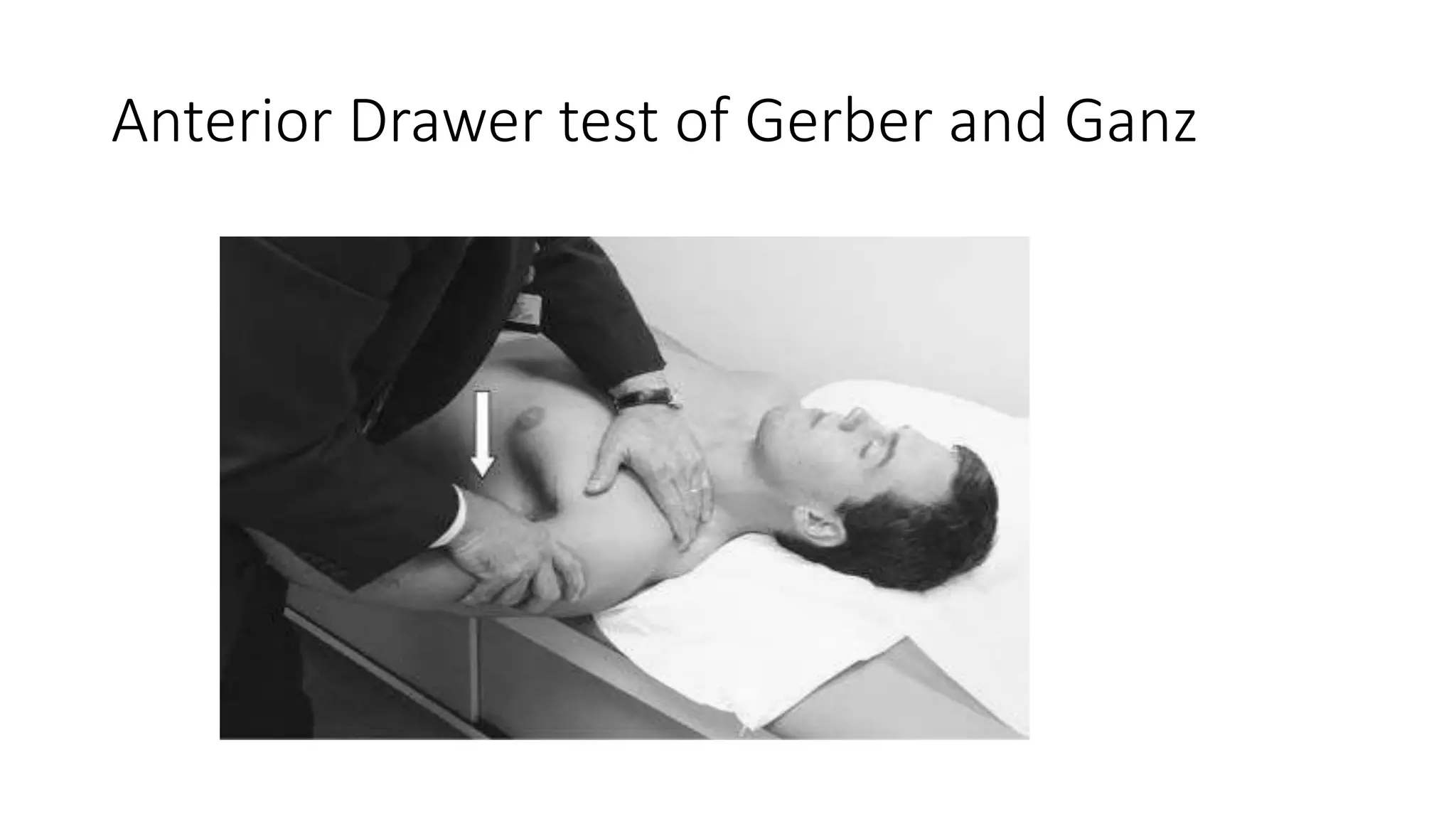 Anterior Drawer test of Gerber and Ganz