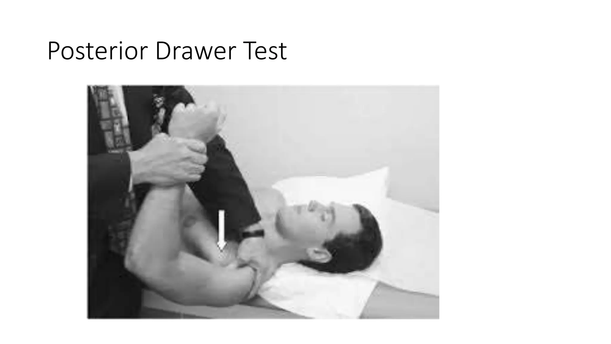 Posterior Drawer Test