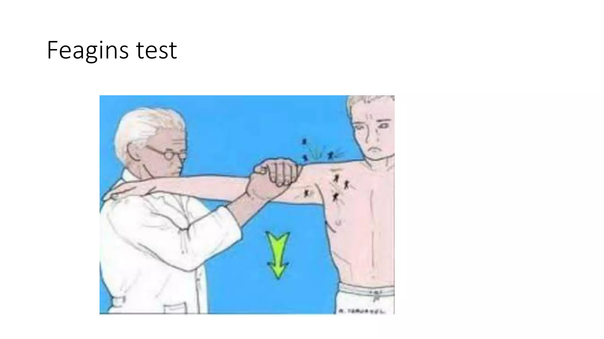 Feagins test