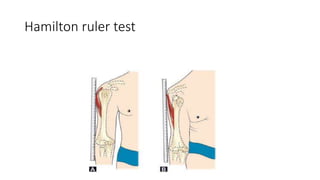 Shoulder special tests-pictoral | PPTX