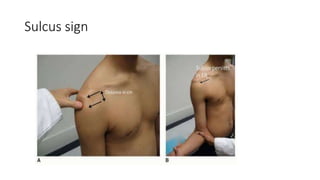 Positive Sulcus Shoulder special tests-pictoral | PPTX