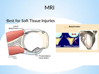 shoulder sports injuries ppt knee and shoulder | PPTX
