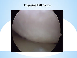 shoulder sports injuries ppt knee and shoulder | PPTX