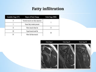 shoulder sports injuries ppt knee and shoulder | PPTX