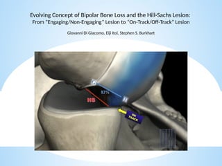 shoulder sports injuries ppt knee and shoulder | PPTX