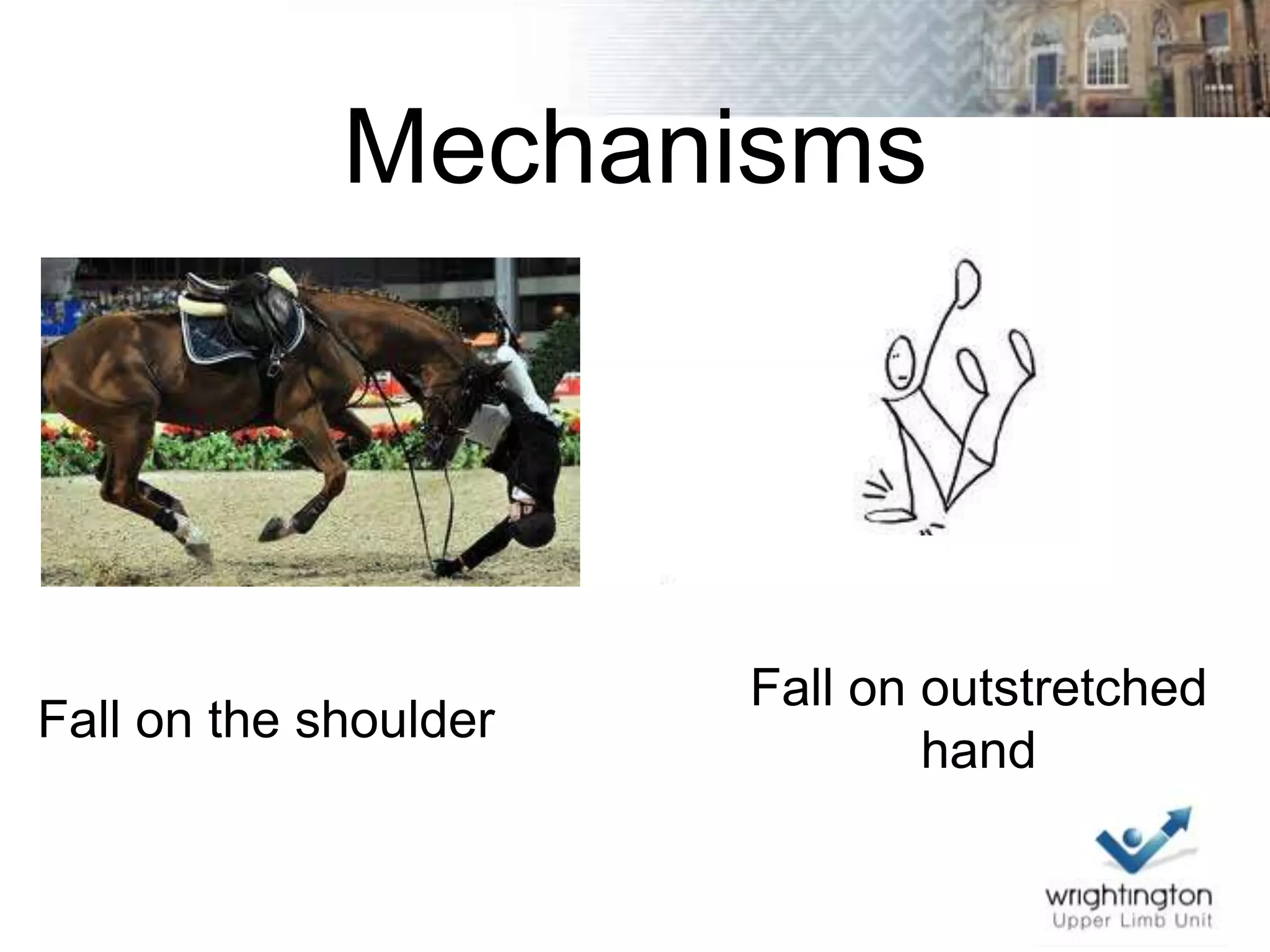 Fall Onto R Shoulder Shoulder sports injury overview and instability basics | PPTX