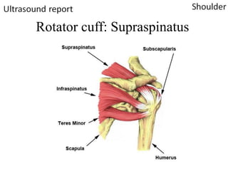 Shoulder Ultrasound Report PDF shoulder-ultrasound-report-pdf