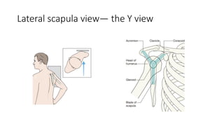 imaging of shoulder -xrays depicting the various views , the bony ...