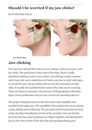 Should I be worried if my jaw clicks?
by Dr Muzzafar Zaman
Jaw Illustration
Jaw clicking
You may have noticed that when you are eating or when you yawn, your
jaw clicks. The good news is that most of the time, there is really
absolutely nothing at all to worry about. Jaw clicking is quite common
and it may only occur sometimes or if when your jaw is really wide open.
In nearly all cases, the jaw clicks only on one side and rarely on both
sides. It usually isn’t painful but the noise of the click can be worrying.
There are however instances when the jaw clicking together with other
signs can be problematic and you may need to do something about it.
The proper biological name for the lower jaw is the mandible and
maxilla for the upper jaw. The mandible is the portion that moves during
eating, talking and swallowing. The jaw joint itself is located just in front
of the skin flap immediately in front of the ear holes. You can feel the
jaw joint moving easily by placing two fingers together and placing them
just on the skin in front of the skin flap and opening/closing your
 