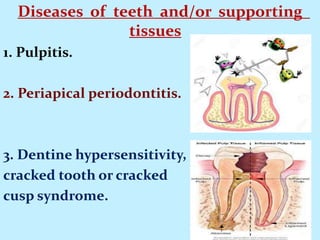 Diseases of teeth and/or supporting
tissues
1. Pulpitis.
2. Periapical periodontitis.
3. Dentine hypersensitivity,
cracked tooth or cracked
cusp syndrome.
 