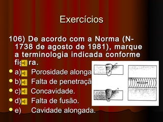 Exercícios
106) De acordo com a Norma (N-
  1738 de agosto de 1981), marque
  a terminologia indicada conforme
  figura.
 a)   Porosidade alongada.
 b)   Falta de penetração.
 c)   Concavidade.
 d)   Falta de fusão.
 e)   Cavidade alongada.
 