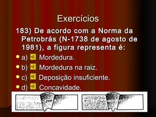 Exercícios
183) De acordo com a Norma da
  Petrobrás (N-1738 de agosto de
  1981), a figura representa é:
 a)   Mordedura.
 b)   Mordedura na raiz.
 c)   Deposição insuficiente.
 d)   Concavidade.
 