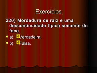 Exercícios
220) Mordedura de raiz e uma
  descontinuidade típica somente de
  face.
 a)  Verdadeira.
 b)  Falsa.
 