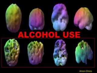 ALCOHOL USEAmen Clinics
