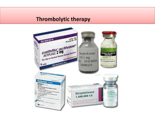 Thrombolytic therapy
 