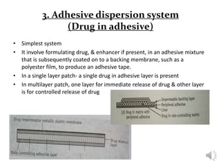 formulation of transdermal patches | PPTX